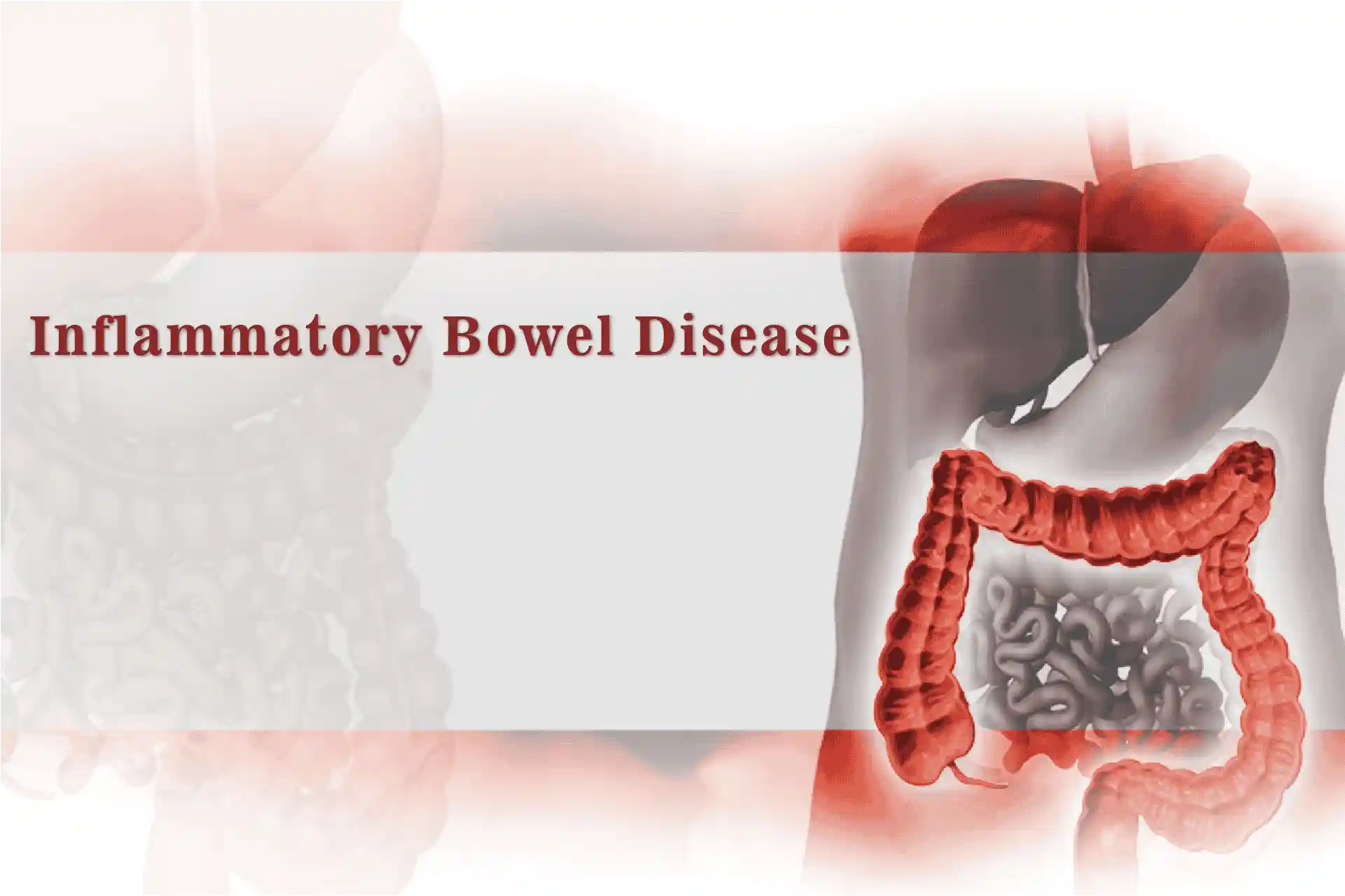 Inflammatory bowel disease